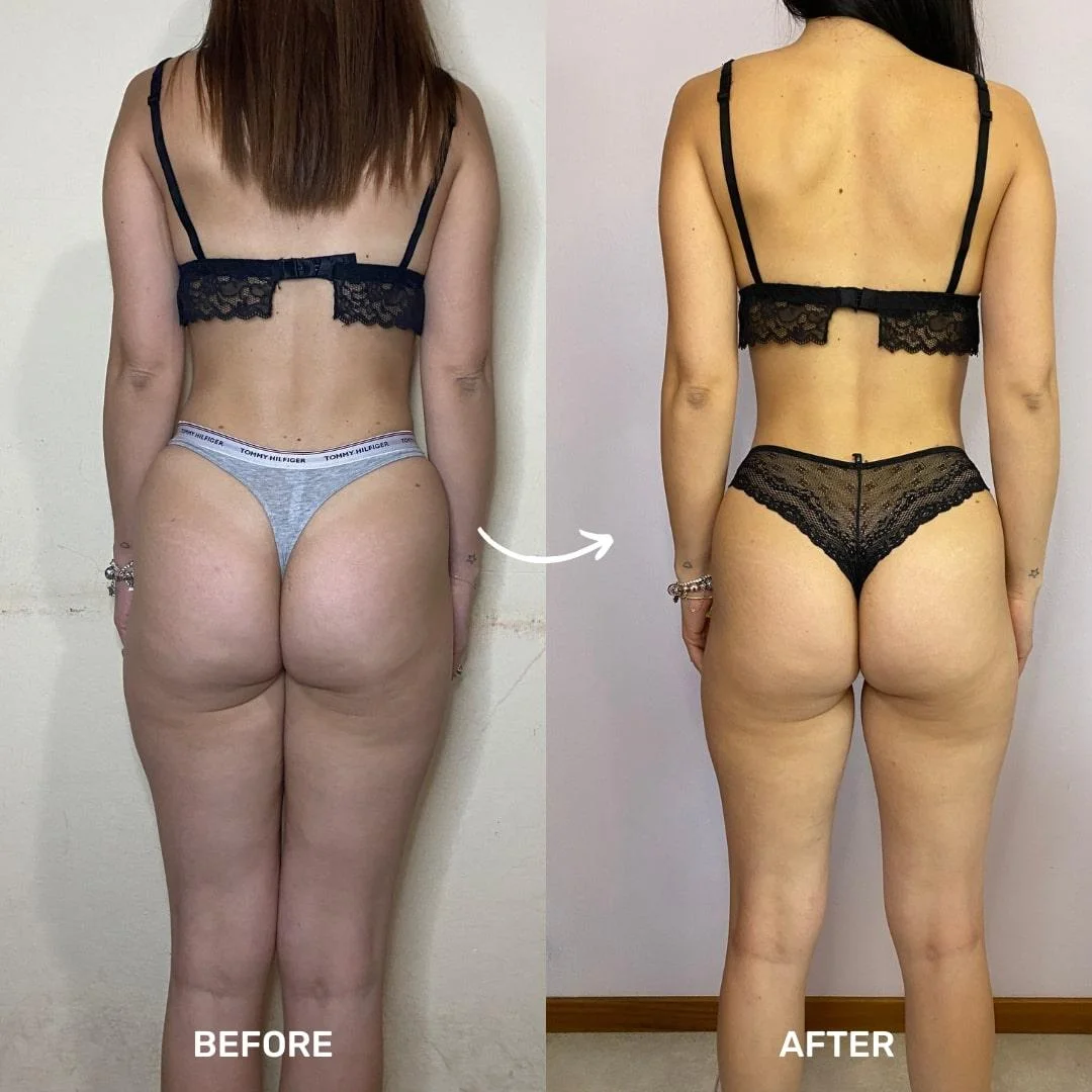 Cliente · +5kg massa muscolare